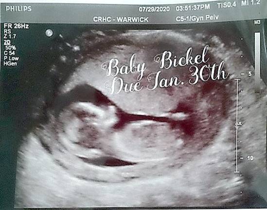 Baby boom or bust? Either way, pregnancy looks different during the coronavirus Crystal VanDuzer’s baby is due in January. Provided photos.