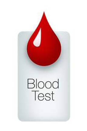 Register for SMAC blood testing by April 11