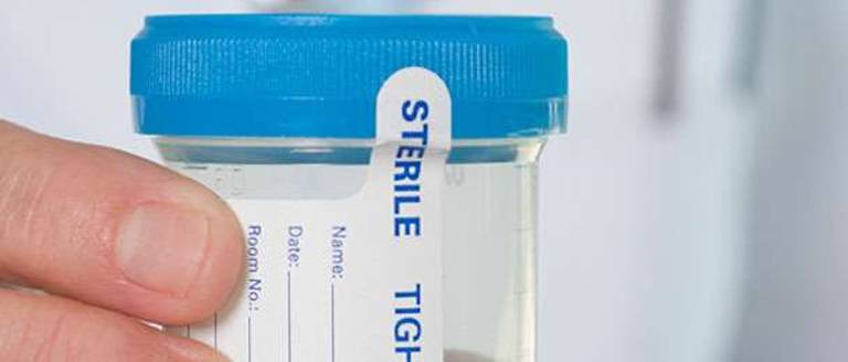 Parents speak out against random drug testing
